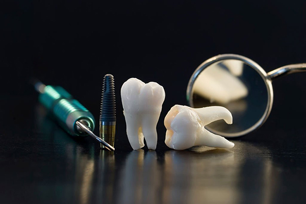 trồng răng implant có đau không