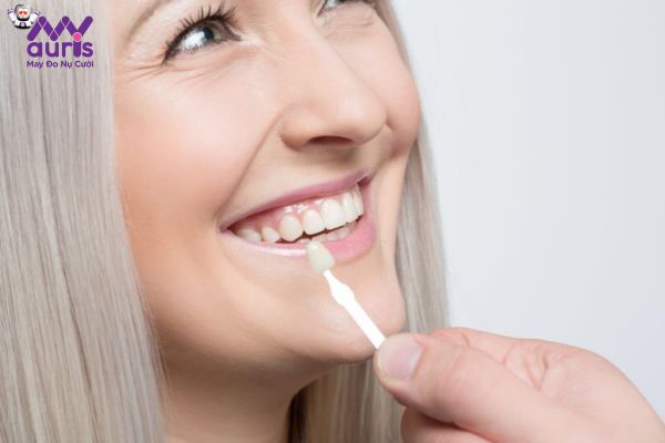 Áp dụng bọc răng sứ 16 cái cho những đối tượng nào?
